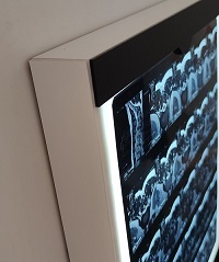 xray viewer