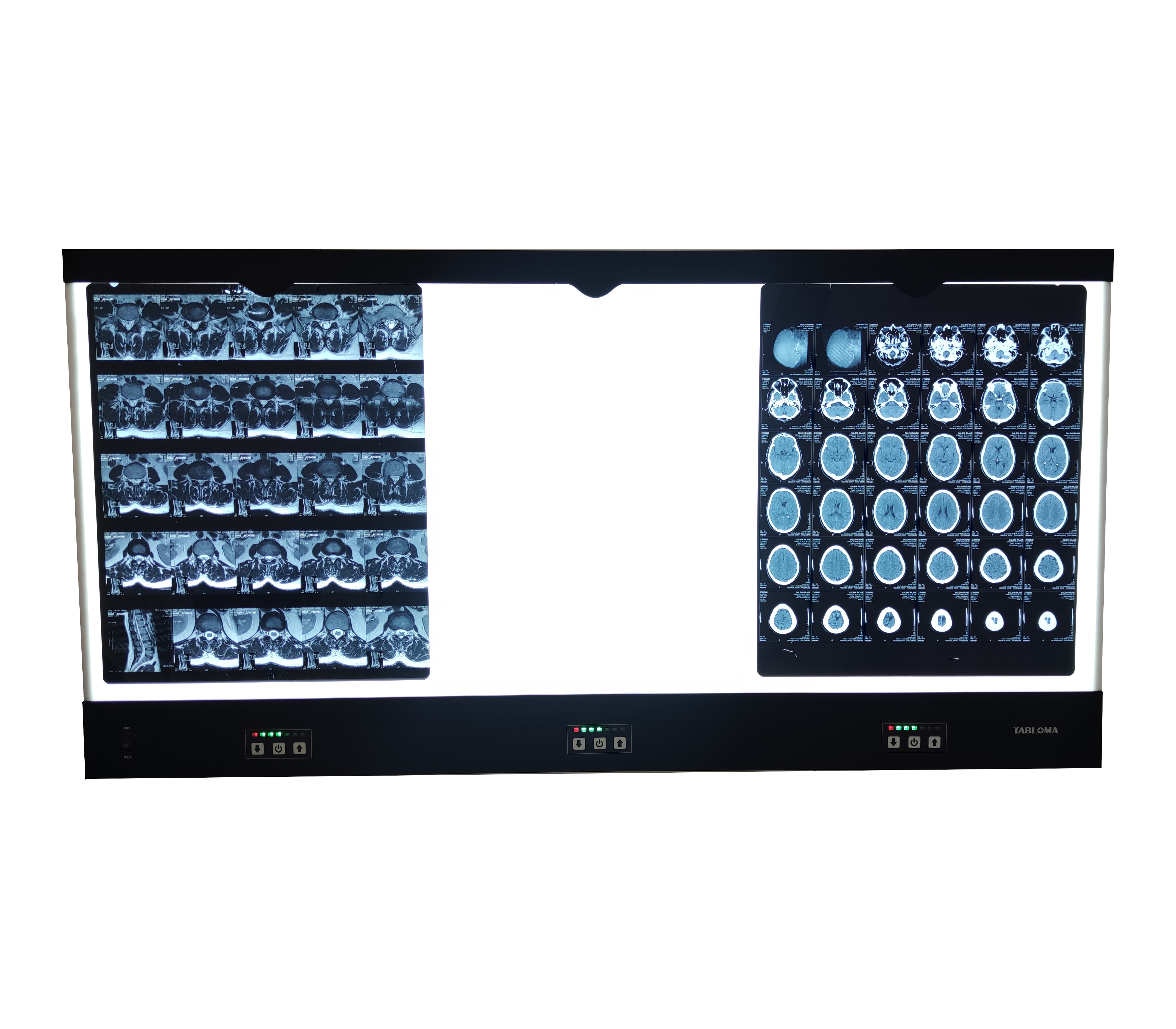 negatoscope three screen x ray viewer